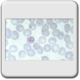 Plasmodium ovale