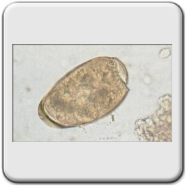 Schistosoma mansoni