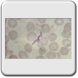 Trypanosoma brucei africano