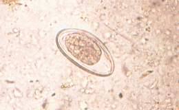 enterobius vermicularis uova)